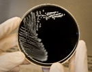 Legionella pneumophila, a bacterium that can cause Legionnaires’ disease, growing on specialized microbiological media (BCYE)