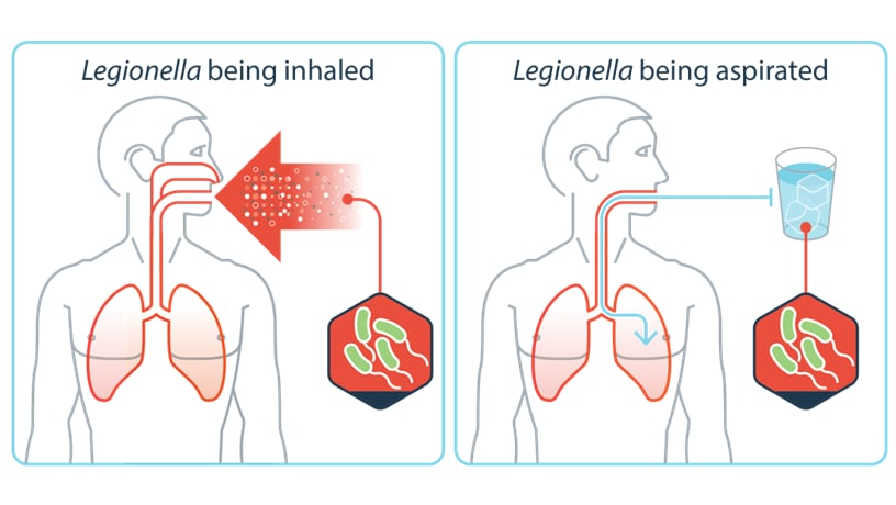 Illustrations showing a person inhaling small droplets of water containing Legionella and getting water in their lungs while drinking.