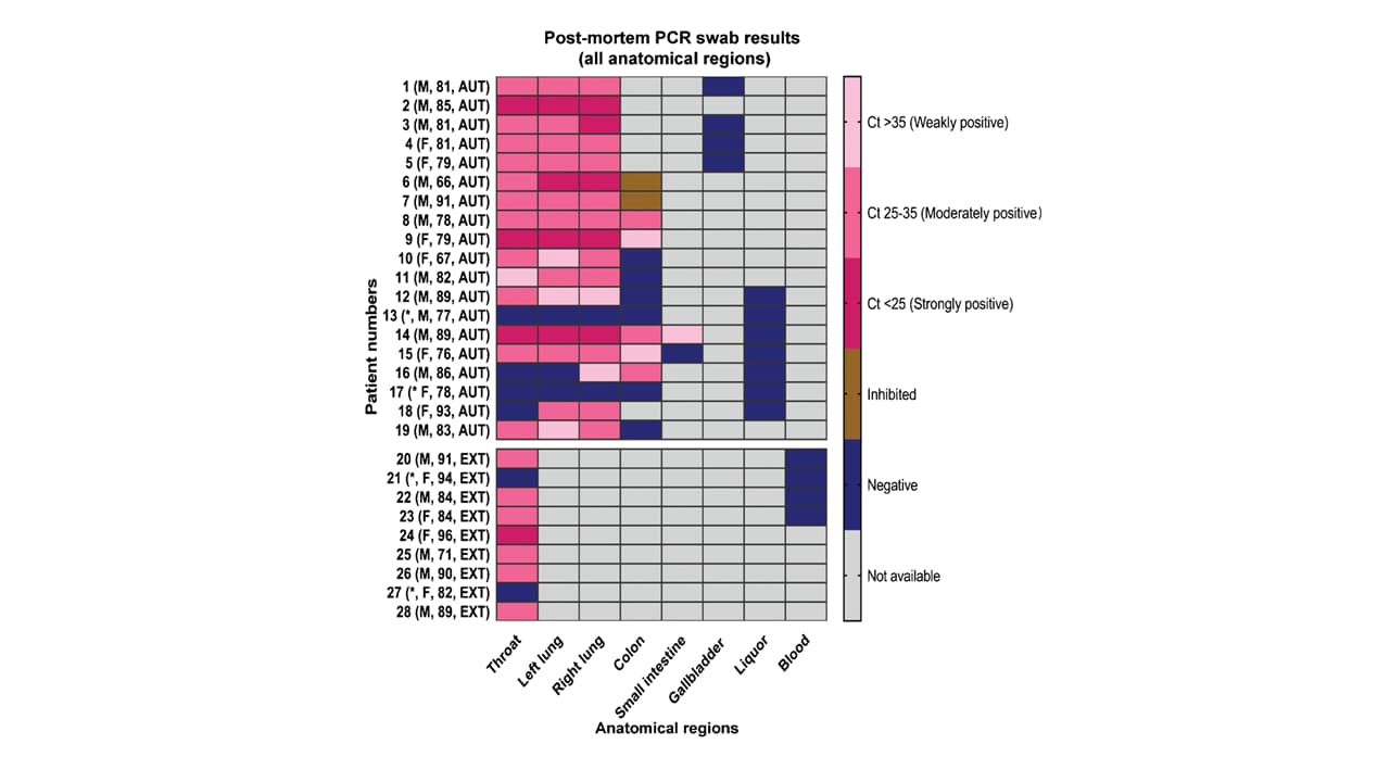 RT-PCR results of collected samples as a heatmap.