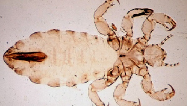 About Head Lice Lice CDC
