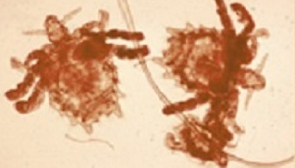 About Pubic "Crab" Lice | Lice | CDC