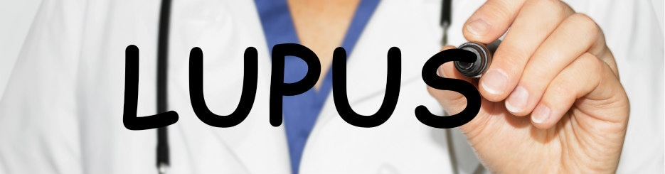 doctor writing the word lupus 