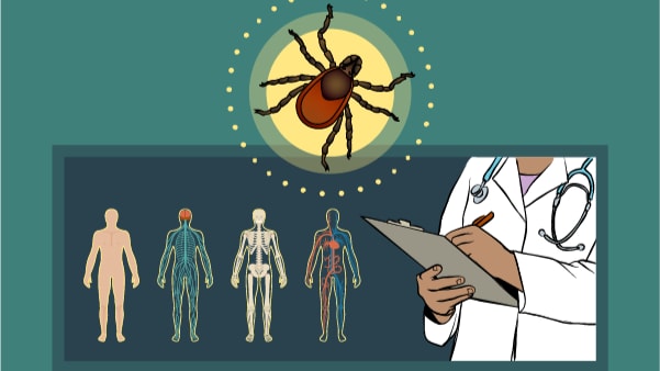 Illustration of a healthcare provider learning how to diagnose and treat Lyme disease