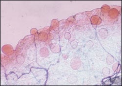 Picture: Oocysts stages of malaria parasites
