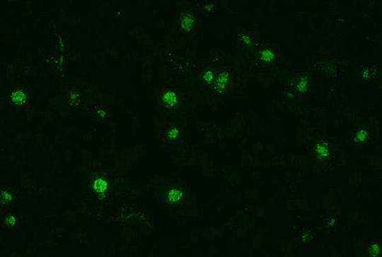 Photomicrograph, showing a dark background against which stand out, fluorescing, approximately 10 parasites of Plasmodium falciparum .