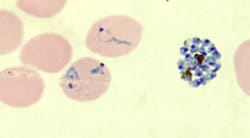 Three Plasmodium vivax parasites in blood smear of patient from Florida outbreak