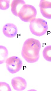 Malaria parasites in the blood of Mansour Adisa.