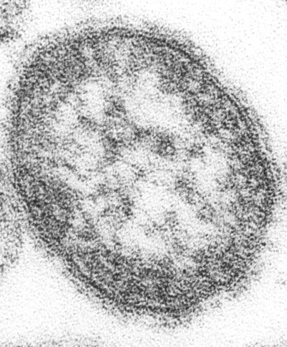 Virus del sarampión bajo el microscopio como microfotografía electrónica de barrido de un corte ultrafino