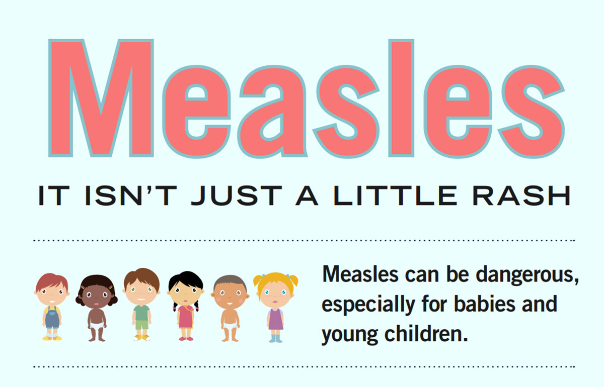 Measles Isn't Just a Little Rash Infographic | Measles (Rubeola) | CDC