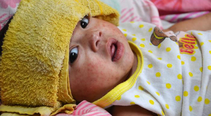 www.cdc.gov