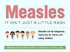 Measles threat to adult health