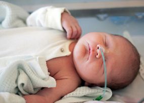 Bebé con un tubo de oxígeno