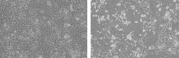 Left: Microscopic image of uninfected Vero/hSLAM cells. Right: Microscopic image of measles-infected Vero/hSLAM cells.