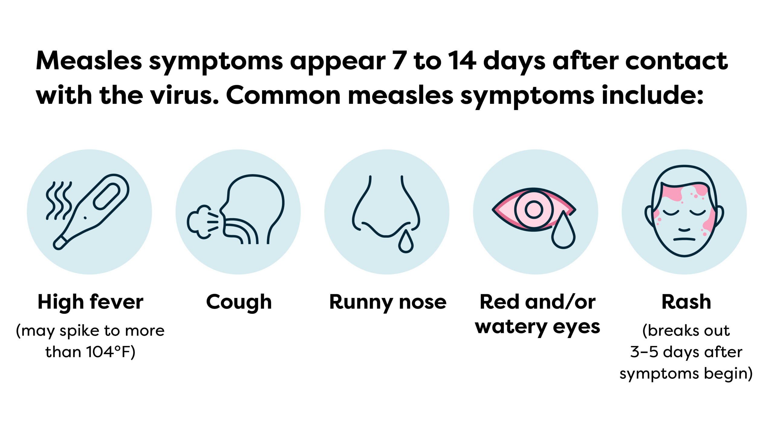 common measles symptoms