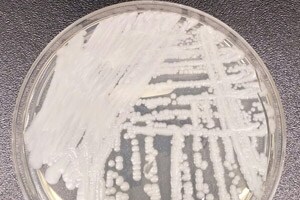 bacterial culture of Candida auris