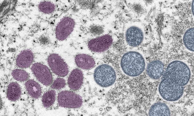 color microscopic image of monkeypox