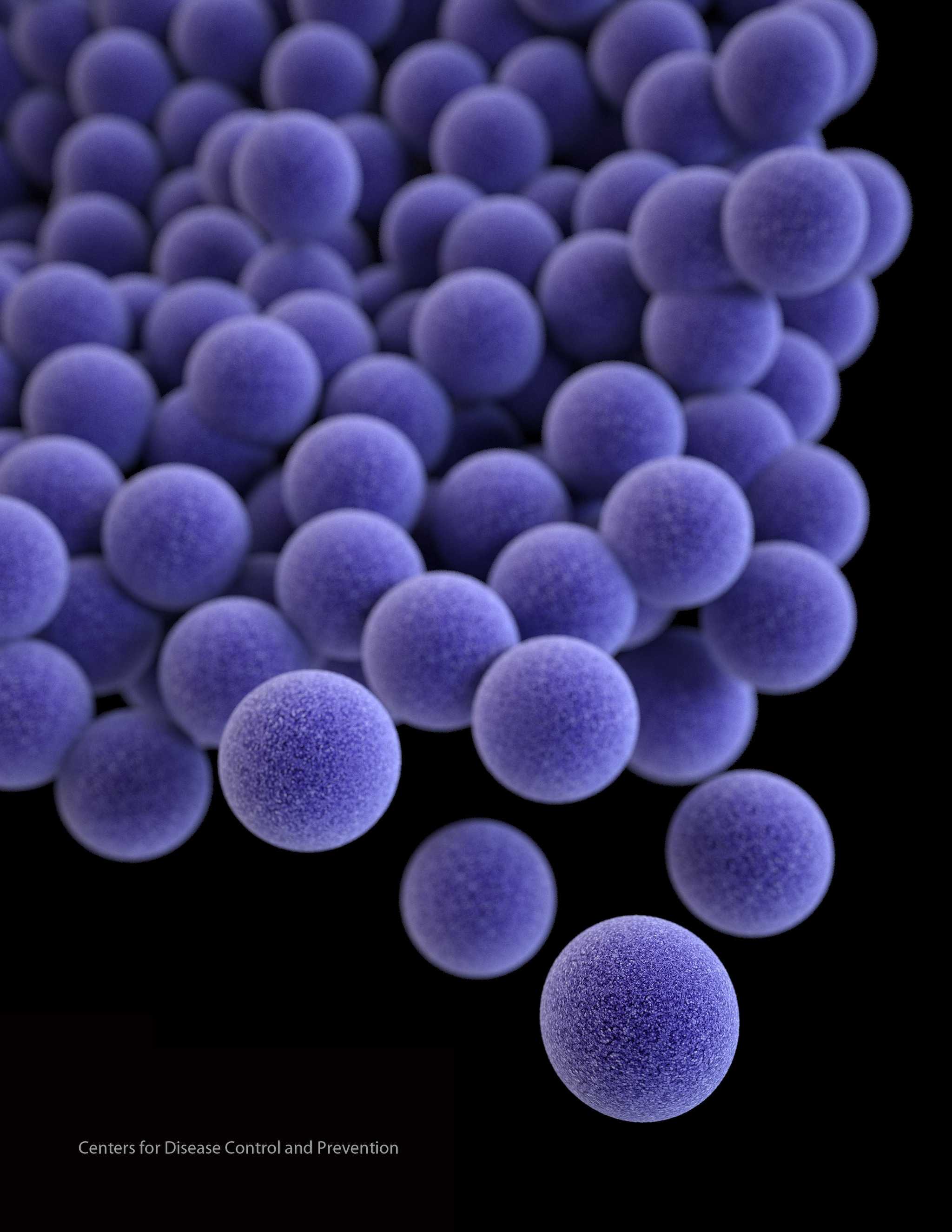 methicillin resistant staphylococcus aureus picture #10