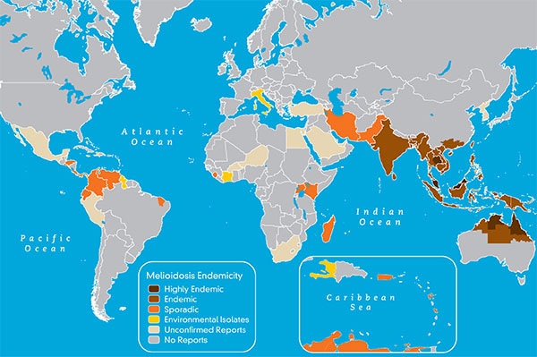 Map showing endemicity of meliodosis infection