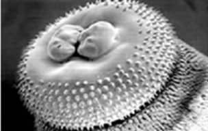 Scanning electron micrograph of a Gnathostoma spinigerum female worm’s head bulb