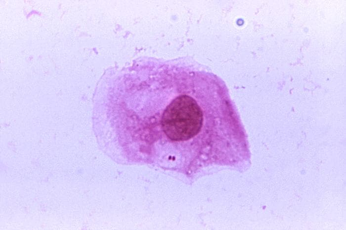 Fotomicrografía de Neisseria meningitidis aislada de la uretra de un hombre asintomático; ampliada 1125X.