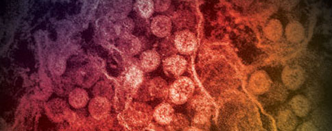 Mers Rady Clinical Overview of MERS | MERS | CDC