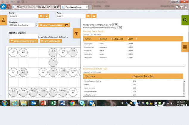 Picture of a screen shot from MicrobeNet showing top 5 results and a list of recommended next tests on the right.