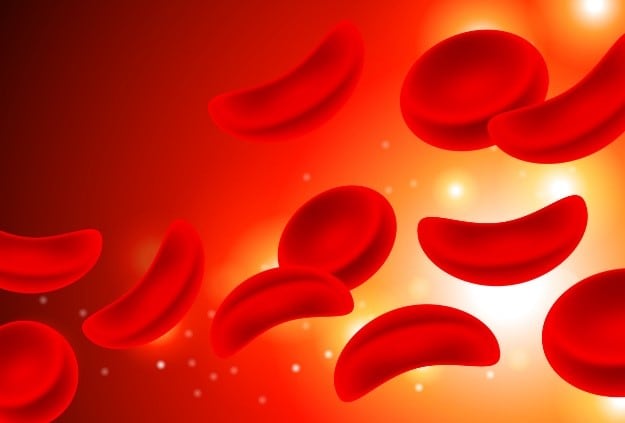 magnification of sickle cell