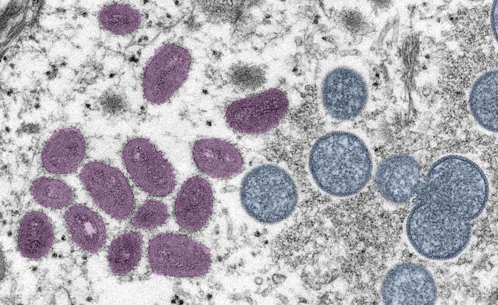 This figure shows a digitally-colorized electron microscopic (EM) image depicted monkeypox virus particles,
