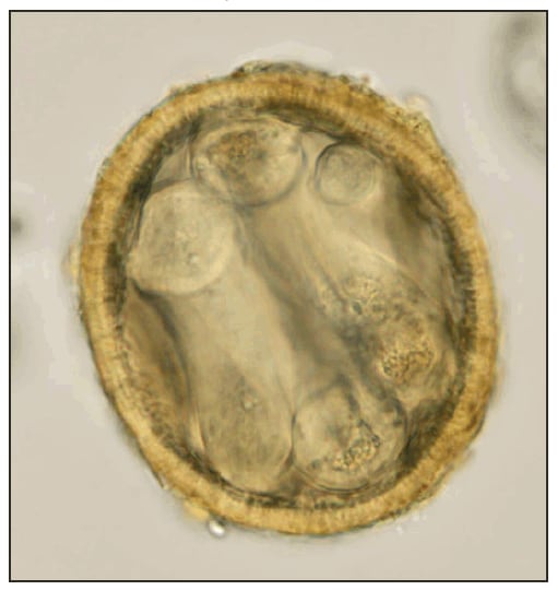 The figure shows an infective (larvated) Baylisascaris procyonis egg, uncovered from the soil under a kinkajou cage in Florida in April of 2010.