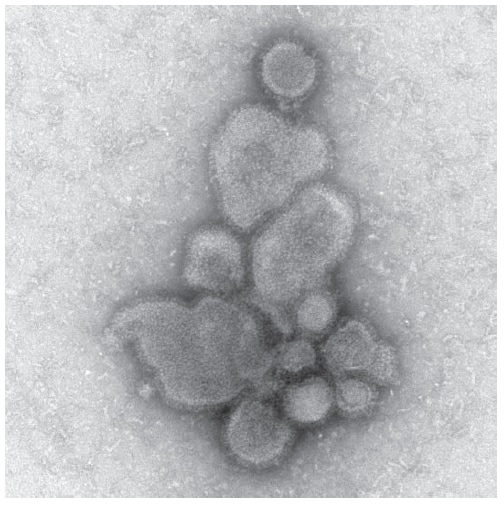 The figure shows an electron micrograph image of influenza A/Anhui/1/2013 (H7N9), showing spherical virus particles characteristic of influenza virions dated April 15, 2013. CDC's Influenza Division Laboratory has received two H7N9 influenza viruses (A/Anhui/1/2013 and A/ Shanghai/1/2013) from the WHO Collaborating Centre for Reference and Research on Influenza at the Chinese Center for Disease Control and Prevention.