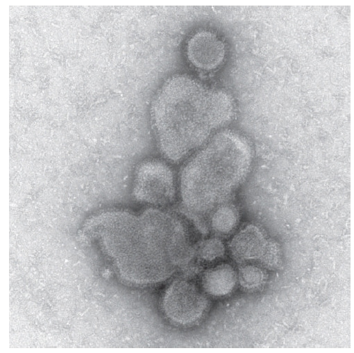 The figure shows an electron micrograph image of avian influenza A/Anhui/1/2013 (H7N9) virus spherical particles characteristic of influenza virions. 