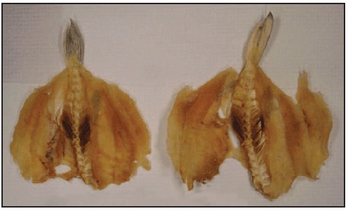 The figure above is a photograph of dried, dressed fillets of puffer fish (Lagocephalus lunaris) obtained from patients in a tetrodotoxin poisoning outbreak in Minneapolis, Minnesota, in 2014.