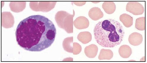 rr6502a1f28.gif This figure is a photograph showing a Wright stain of peripheral blood smears showing an intramonocytic morula associated with Ehrlichia chaffeensis infection (left) and an intragranulocytic morula (right), such as associated with Ehrlichia ewingii or Anaplasma phagocytophilum infection.