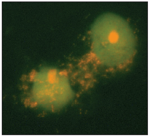 rr6502a1f30.gif This figure is a photograph showing an acridine orange stain of Rickettsia africae isolated in Vero E6 cells from an eschar biopsy specimen from a patient with African tick bite fever.