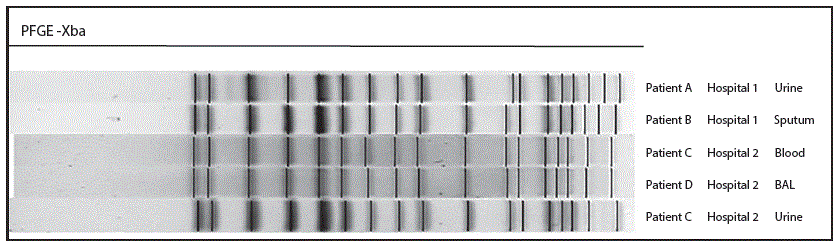 The figure above is a pulsed-field gel electrophoresis subtyping comparison of five KPC-producing Klesbsiella pneumoniae isolates digested with XbaI in Wisconsin during February–May 2015.