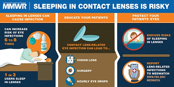 The figure above is a visual abstract that discusses the risk for sleeping in contacts.