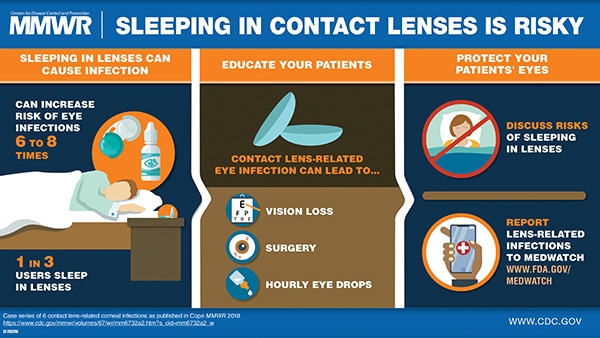 Corneal Infections Associated with Sleeping in Contact Lenses — Six Cases, United States, 2016–2018