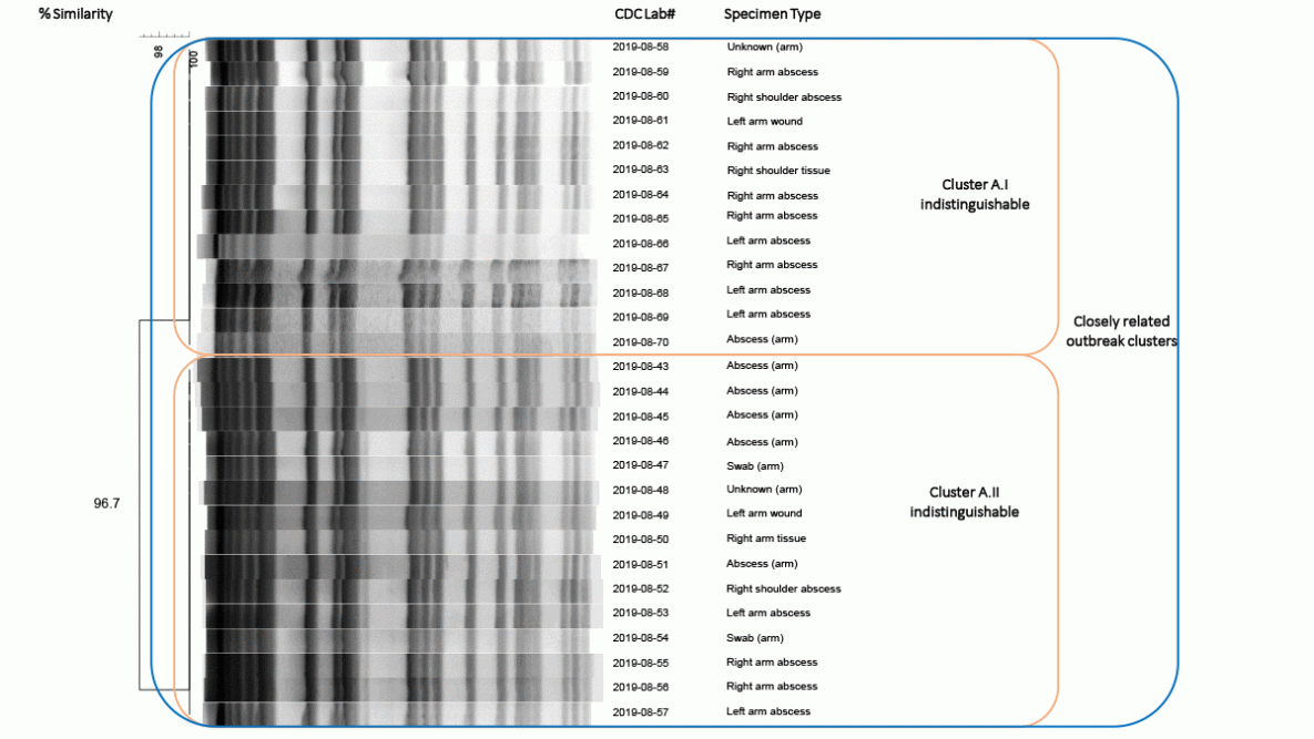 Mycobacterium porcinum Skin and Soft Tissue Infections After Vaccinations — Indiana, Kentucky, and Ohio, September 2018–February 2019 Figure is a pulsed-field gel electrophoresis dendrogram of 28 Mycobacterium porcinum specimens isolated from patients vaccinated by company A in Kentucky and Ohio during September 2018–February 2019.