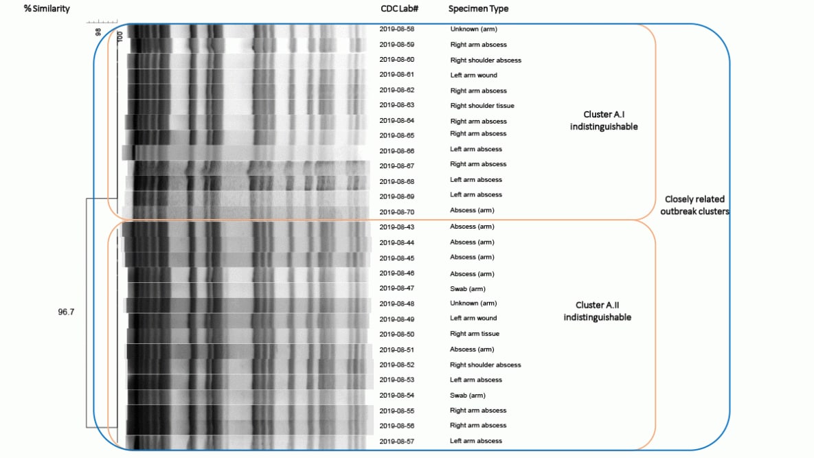 Figure is a pulsed-field gel electrophoresis dendrogram of 28 Mycobacterium porcinum specimens isolated from patients vaccinated by company A in Kentucky and Ohio during September 2018–February 2019.