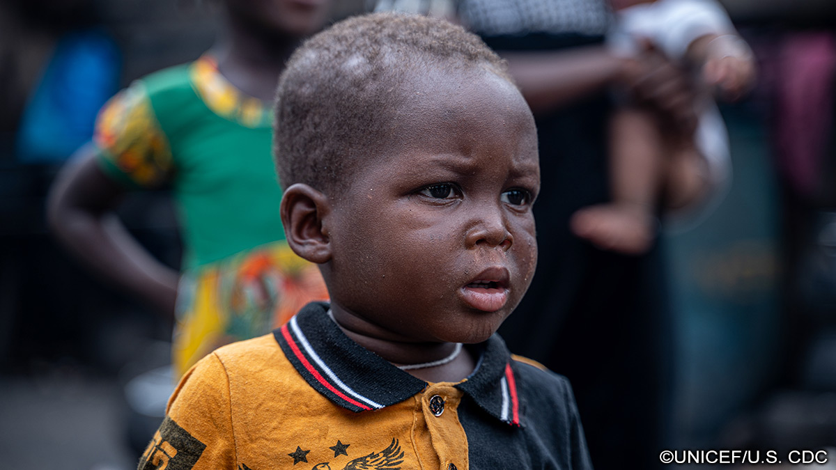 Progress Toward Measles Elimination — African Region, 2017–2021 | MMWR