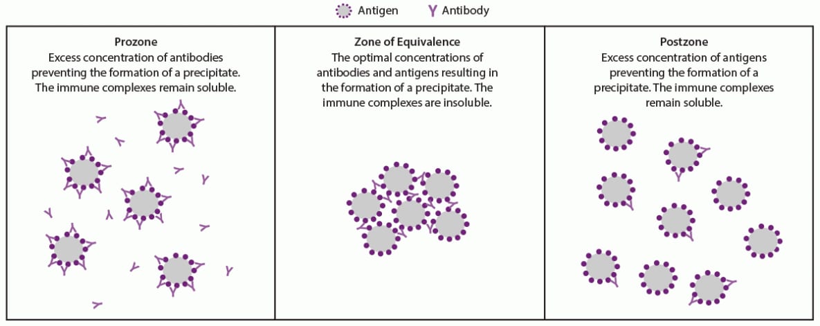 Figure illustrates the serologic effect of antibody and antigen concentrations on agglutination in the prozone, zone of equivalence, and postzone following treatment for syphilis.