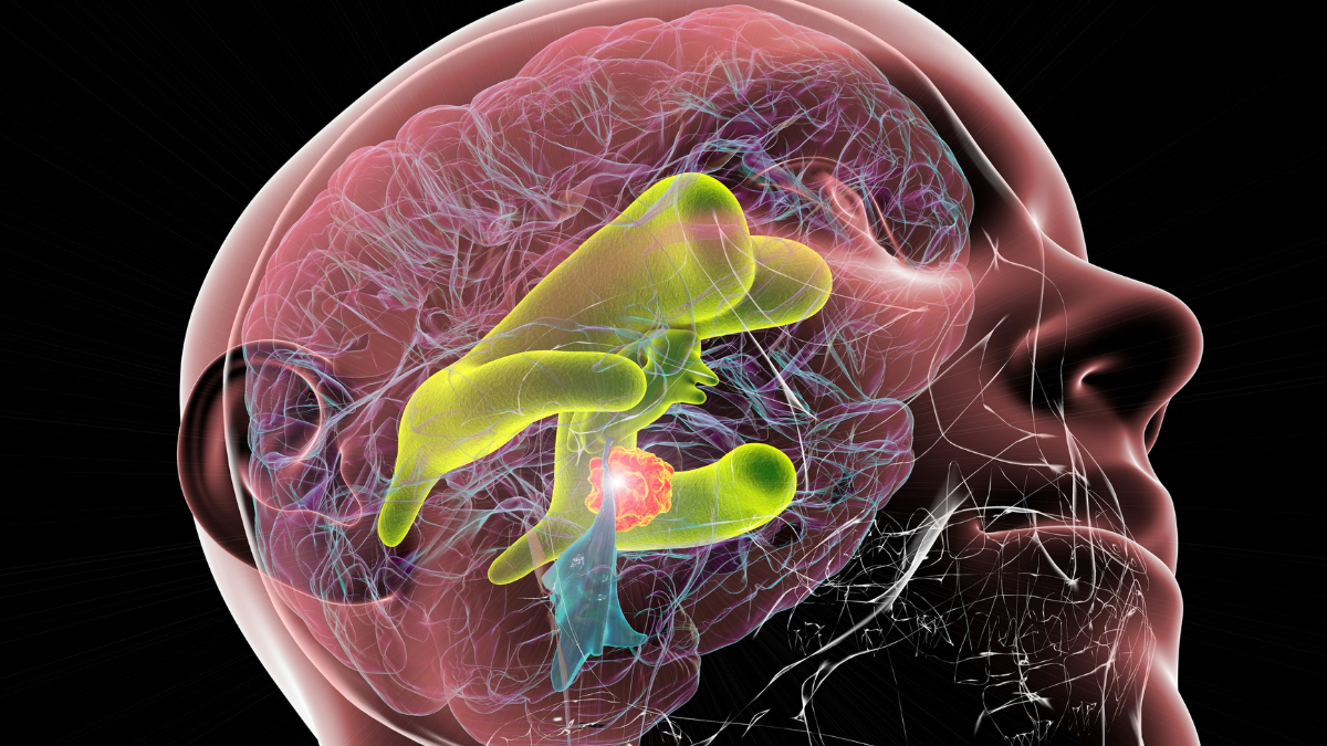 Infections Associated with Medtronic Duet External Ventricular Drains ...