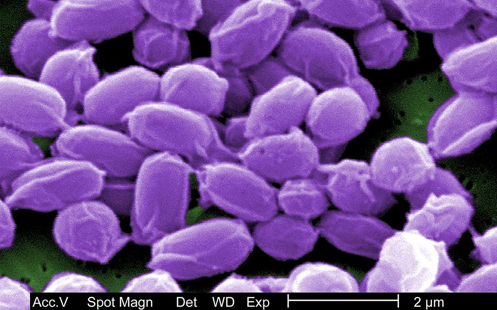 Anthrax spores under high magnification.