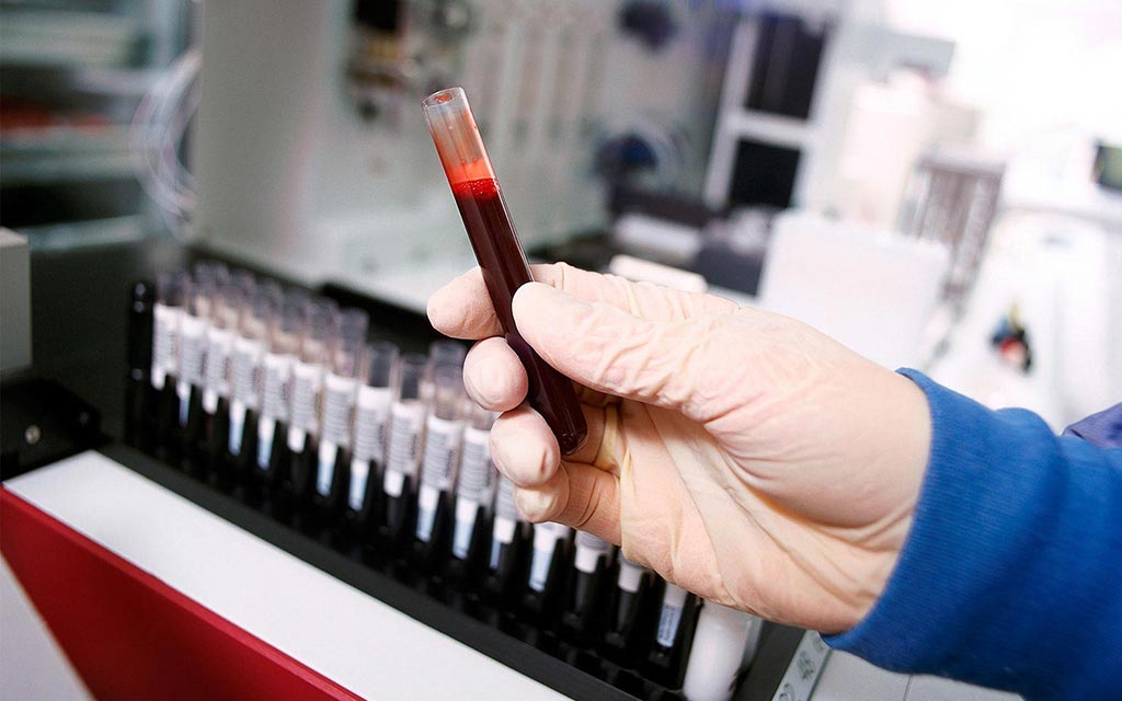 Blood samples at a lab.