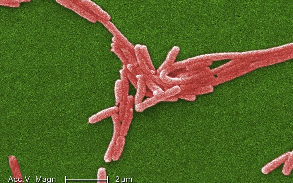 Legionnaires' disease bacterium as seen through a scanning electron micrograph (SEM)