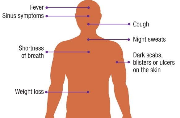 a silhouette of a person with labelled signs and symptoms pointing to body parts