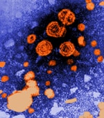 Hepatitis B Virions