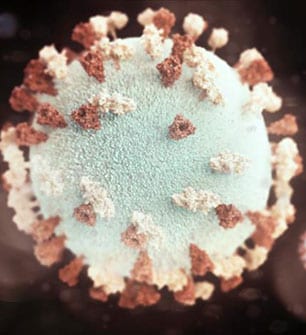This illustration provides a 3D graphical representation of a spherical-shaped, mumps virus particle that is studded with glycoprotein tubercles.