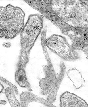 This 1977 thin sectioned transmission electron micrograph (TEM) depicted the ultrastructural details of the mumps virions that had been grown in a Vero cell culture.