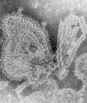 This 1976 negative stained transmission electron micrograph (TEM) depicted the ultrastructural features displayed by the mumps virus.